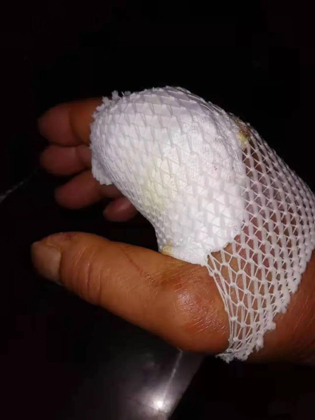 开云体育APP下载-福建泉州队员因伤退出球队，伤情严重